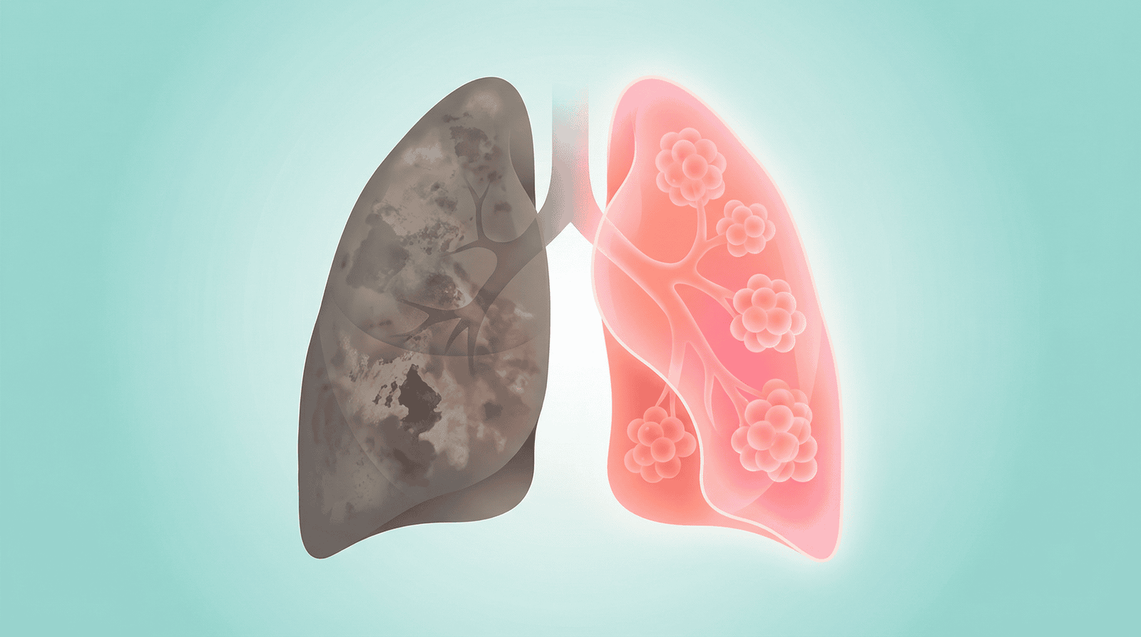 How Your Lungs Heal After Quitting Smoking: A Visual Timeline